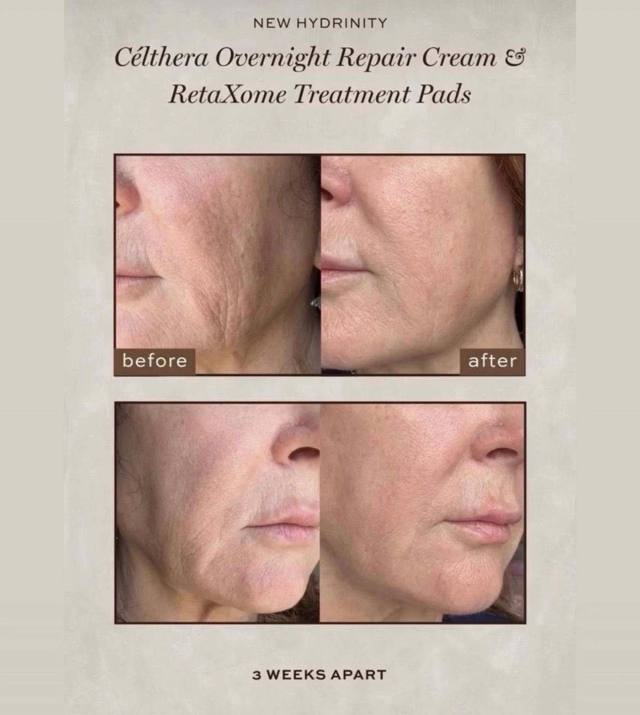 Hydrinity Overnight Renewal Duo