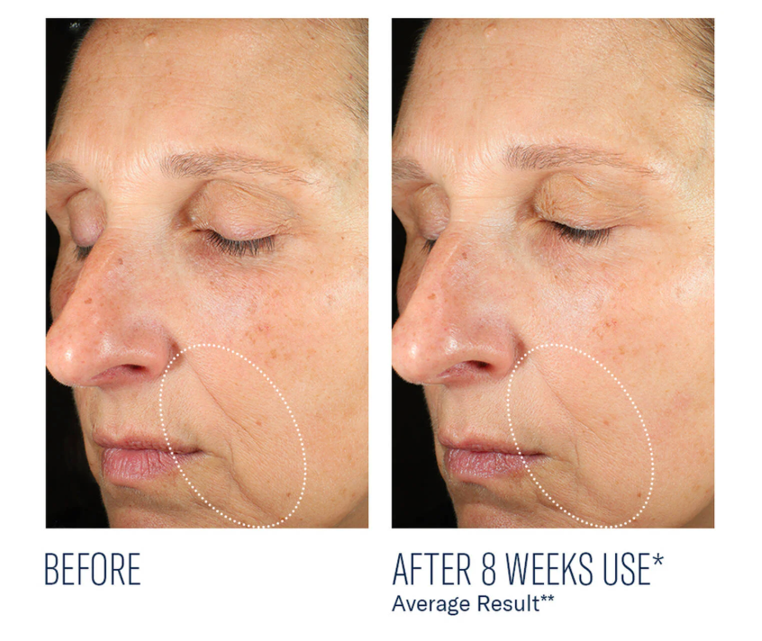 Mystro Revive Renewing Serum